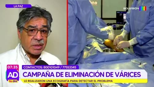 Endoven acompaña a María Challco tras 23 años de sufrir várices