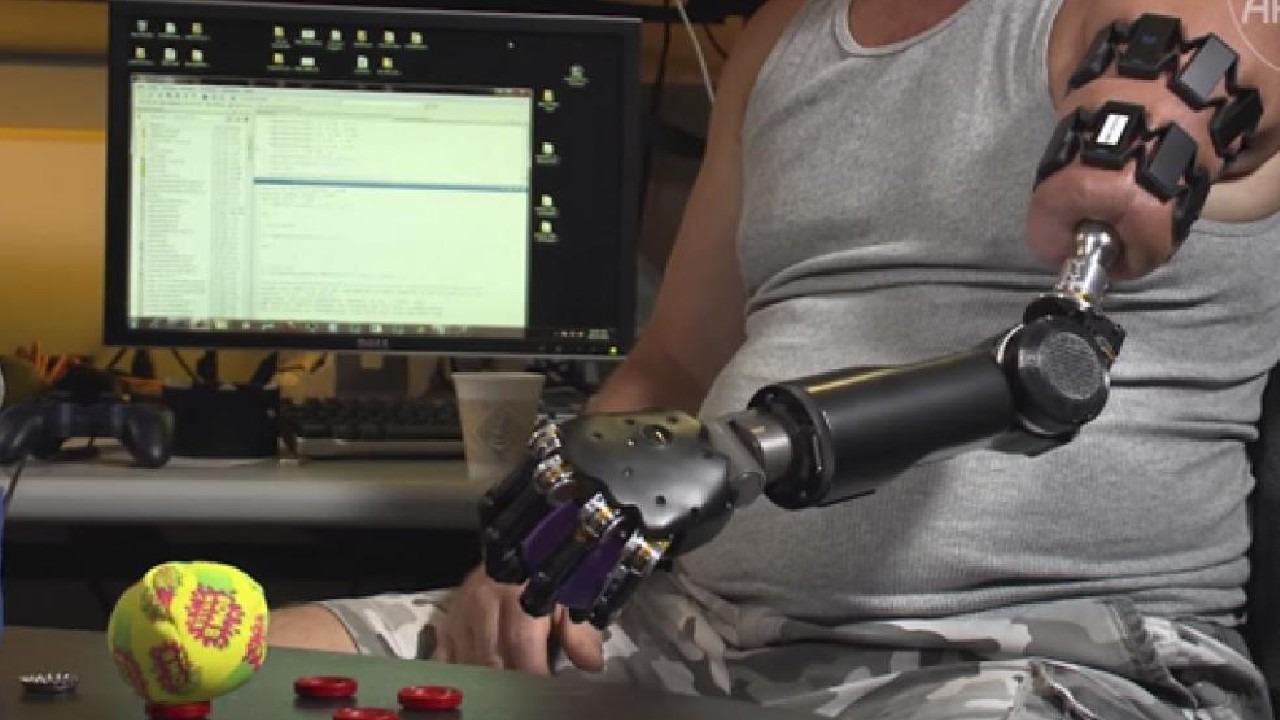 Врач делающий протезы. Джесси Салливан бионические протезы. Современные протезы рук. Роботизированные протезы. Бионический протез предплечья.
